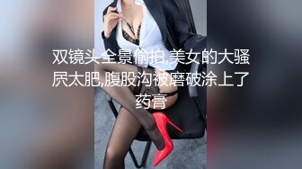 双镜头全景偷拍,美女的大骚屄太肥,腹股沟被磨破涂上了药膏